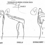 Tendon Gliding Exercise